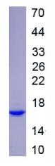SDS-PAGE (NEFL-2484H).jpg